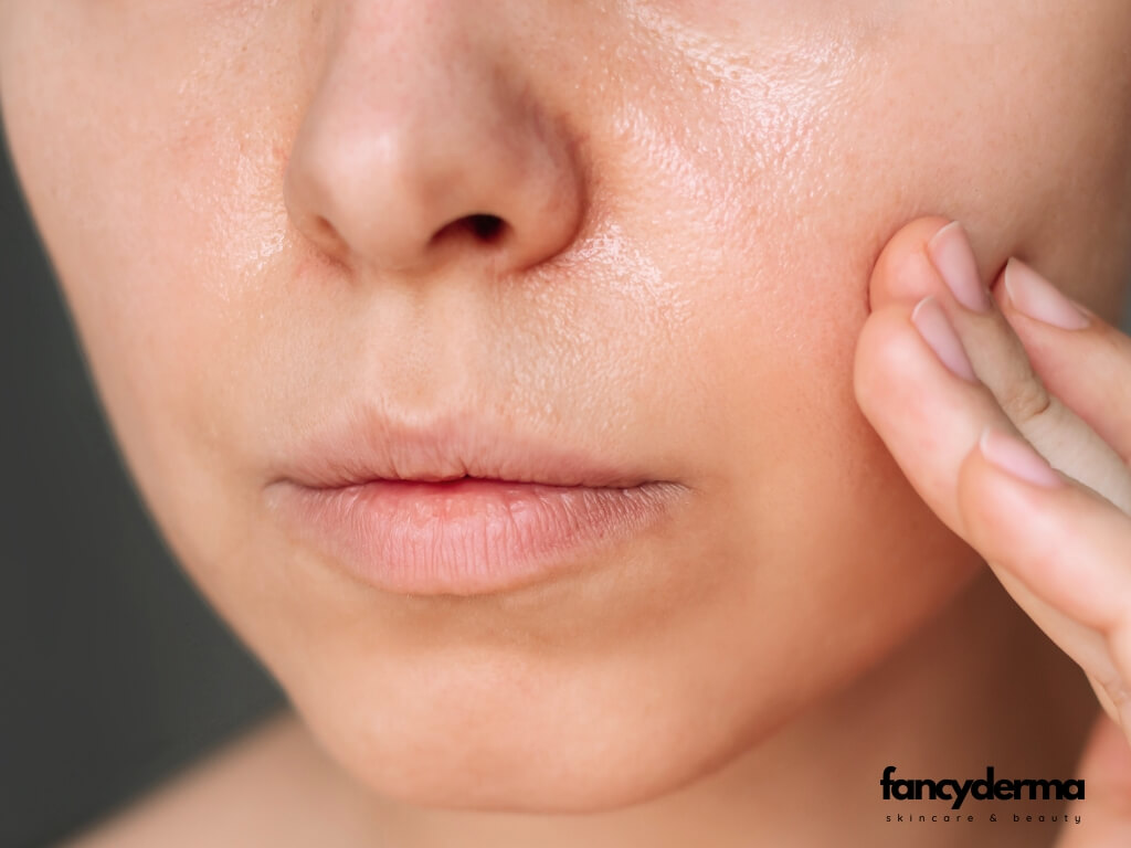 Cách trị da dầu - Hướng dẫn chi tiết 7 bước skincare để kiểm soát dầu thừa và sở hữu làn da mịn màng 1 Da dầu khá phổ biến tại Việt Nam trong điều kiện khí hậu nóng ẩm
