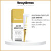 Kem Trị Mụn Acne Remover Renoskin 10ML đầu bút vàng, công nghệ Hàn Quốc, trị mụn hiệu quả, phân phối bởi Fancyderma.