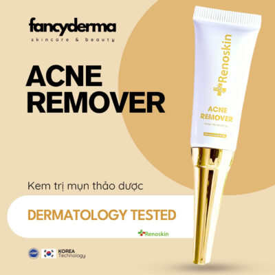 Kem Trị Mụn Acne Remover, Khô Cồi Mụn, Giảm Viêm, Sạch Chân Lông 10ML 10 Kem Acne Remover Renoskin 10ML vàng kim, thiết kế tiện lợi, giảm viêm, sạch chân lông, đạt chuẩn FDA, từ Fancyderma.