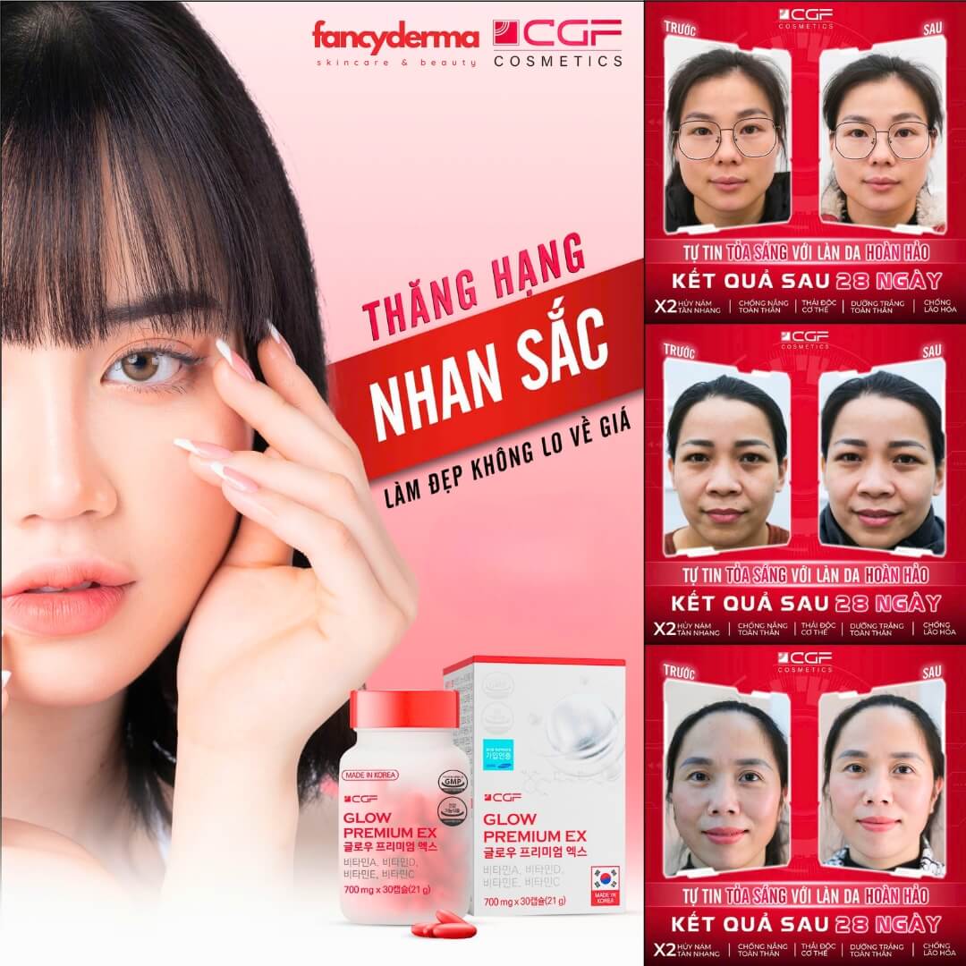Viên Uống Trắng Da CGF GLOW AND BEAUTY PREMIUM EX, Trắng Da Toàn Thân, Mờ Thâm Nám, Đẹp Da 21g 5 Hiệu quả trước và sau khi dùng viên uống sáng da CGF Glow Premium EX, giảm thâm nám và sáng da rõ rệt - Mua ngay tại Fancyderma