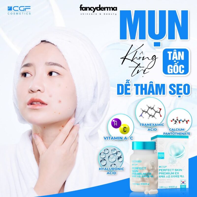 Làn da sáng mịn, sạch mụn nhờ thuốc uống giảm mụn CGF Perfect Skin Premium EX, chuẩn y khoa Hàn Quốc.