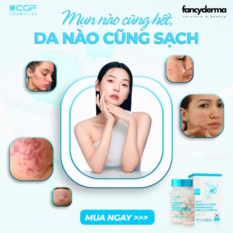 Phụ nữ tự tin khoe làn da sạch mụn, se khít lỗ chân lông với thuốc uống giảm mụn CGF Perfect Skin Premium EX.