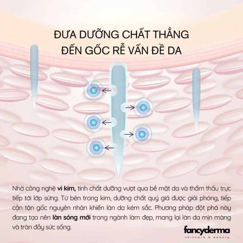 Vì Sao Tinh chất vi kim Prier Neige Eve Rich có thể cấp ẩm với công nghệ vi kim tái tạo da hiệu quả.