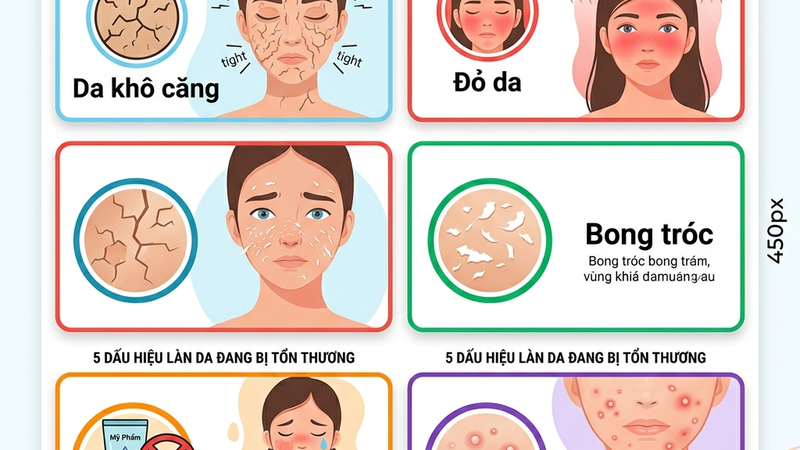 Dấu hiệu skin barrier tổn thương